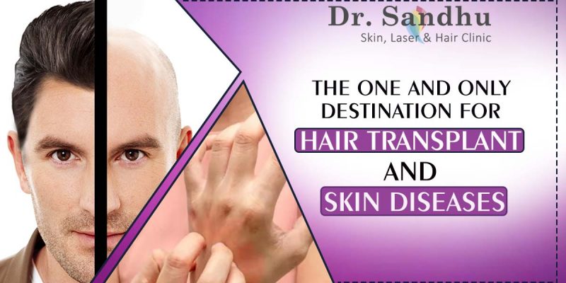 Dr Sandhu Skin, Laser & Hair Clinic